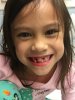 TiffyMissingToothsm.JPG