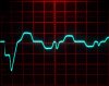 inrush_current_5a-5ms-div.jpg