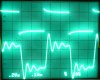 10KHz + 1uF.JPG