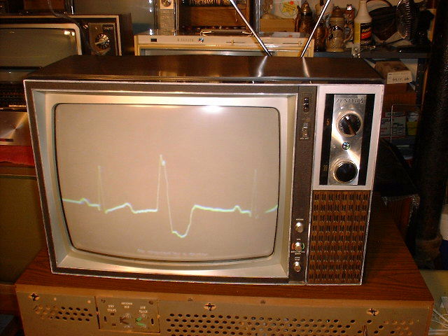 1972 Zenith 19CC19